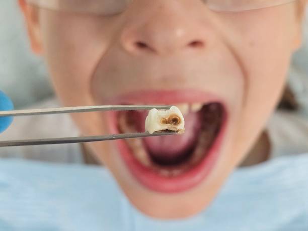 Best Same-Day Emergency Dentist in Munfordville, KY