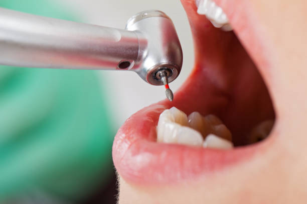Best Emergency Dental Surgery in Munfordville, KY
